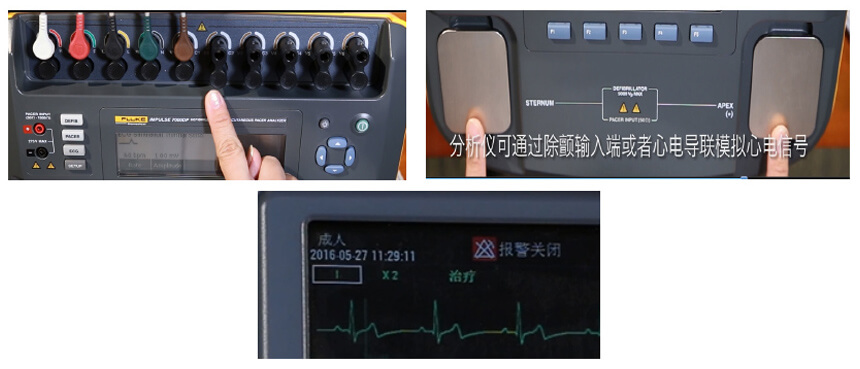 調整被測(ce)設(shè)備(bei)的(de)心電(dian)輸(shu)入方(fang)式(shi)