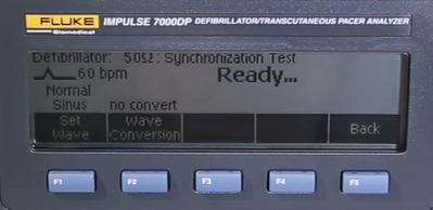 除顫器(qi)同步延遲時間測(ce)試