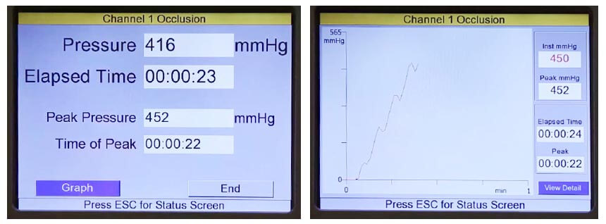 設(shè)置被測(ce)輸(shu)液設(shè)備(bei)